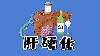 ＃医学手绘 | 肝硬化十大病因 Medical hand drawing | Ten causes of liver cirrhosis