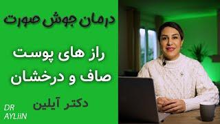 درمان جوش و آکنه با دکتر آیلین