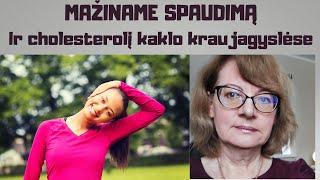 Mažiname kraujo spaudimą ir cholesterolį kaklo kraujagyslėse