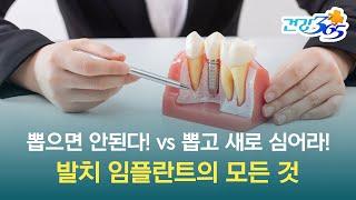 디지털 임플란트 바로 알기 | 발치의 모든 것! 무조건 뽑으면 안된다! vs 뽑고 새로 심어라! 누구 말이 맞는 걸까요?
