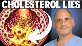 Top Doctors Share the TRUTH About Cholesterol (& Carnivore Diet)