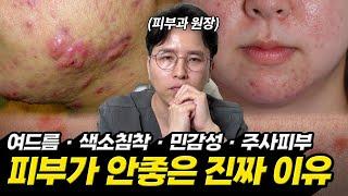 피부타입MBTI 5분만에 내 진짜 피부타입 확인하는법!