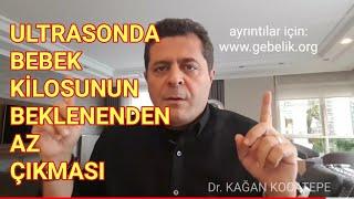 Ultrasonda bebek ölçümlerinin ufak çıkması, kilosunun az olması gelişme geriliği anlamına gelir mi?