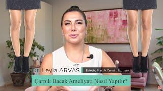 ÇARPIK BACAKLAR İÇİN ÇÖZÜM AMELİYAT MI? | Op. Dr. Leyla Arvas