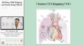 Defining TNM Staging and Early Stage NSCLC