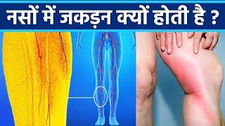 नसों में जकड़न क्यों होती है | नसों में जकड़न होने का कारण | Boldsky*Health