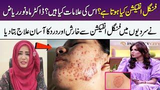 Fungal Infection Of Skin | Symptoms, Causes & Treatment | Dr. Mahnoor Riaz | Meri Saheli | SAMAA TV