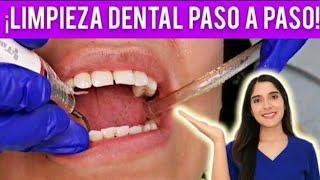 ¿CÓMO SE HACE UNA LIMPIEZA DENTAL DE CONSULTORIO? | TE MUESTRO CADA PASO 