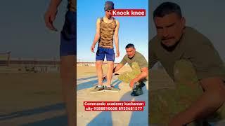 Knock knee problems || army medical test live