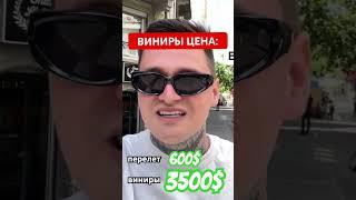 Виниры цена. Почему так дешево? #shorts #путешествие #vlog