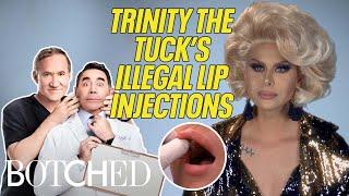 Trinity The Tuck's Botched Lip Injections | Botched | E!