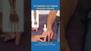 Are Trigger Points Causing Pain In Your Fingers?