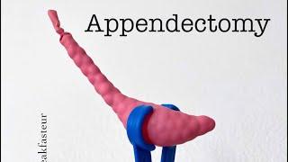 Playdough Surgery 🪱 - Open Appendectomy