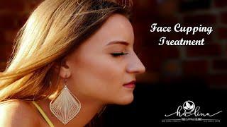 Face Cupping Treatment | Halina Cupping Clinic | Chennai