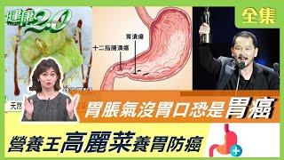 胃脹氣 食慾不振 不單純！6成 胃癌 發現已晚期 健康2.0 20210425 (完整版)