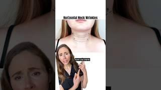 Get Rid Of Neck Wrinkles Fast At Home!  #dermatologist