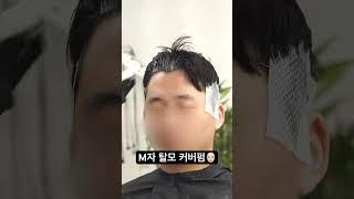 M자 탈모머리 드루와🫵 너의 헤어스타일을 부탁해