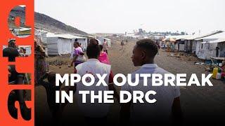 DRC: The Mpox Epidemic | ARTE.tv Documentary