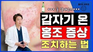 붉은 뺨  딸기코 홍조증상 이렇게하면 좋아집니다. 홍조증상치료하는 방법부터 예방까지 자세히 알려드려요.