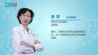 【脂溢性皮炎】脂溢性皮炎是真菌感染吗？