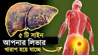 এই 5 টি সাইন দেখলে সাবধান হয়ে যান | 5 Early Signs Of Liver Damage