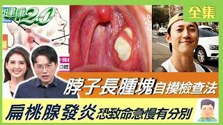 脖子長腫塊 醫師教你自摸檢查法！ 扁桃腺發炎恐致命急慢有分別 耳朵顏色看身體疾病！健康2.0 20230514【完整版】江坤俊 韋汝 吳昭寬 柳朋馳 陳曉萱 陳麗華 潘瑋翔 @tvbshealth20