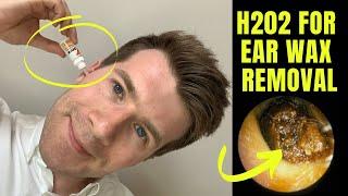 How to remove EAR WAX at home using HYDROGEN PEROXIDE (H202) solution | Doctor O'Donovan explains