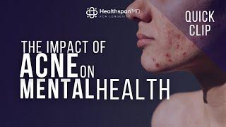 The impact of acne on mental health