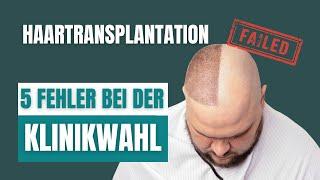 Die 5 größten Fehler bei der Klinikwahl - Haartransplantation Tipps