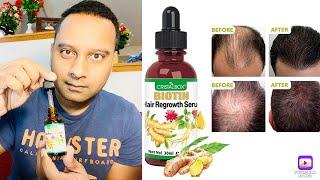 Use Daily Grow New Hair Biotin HAIR growth SERUM stop THINNING hair