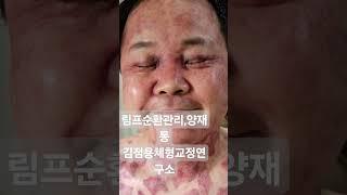 림프순환관리,림프부종,혈액순환장애,전신몸관리