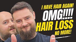 OMG! I Have Hair Again! My Hair System Transformation! Hair Loss No More!