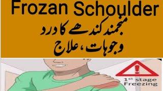 منجمند کندھے کا درد frozan schoulder ka ilaj