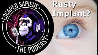 Why don't bionic implants rust? | Gregg Suaning | Escaped Sapiens Podcast