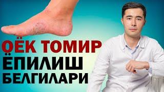 ОЁК ТОМИРЛАРИ ЁПИЛИШ БЕЛГИЛАРИ. КЕЧ БУЛМАЙ БИЛИБ ОЛИНГ