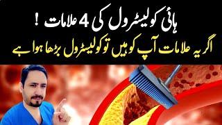 4 Warning Signs of High Cholesterol - Dr Irfan Azeem