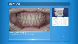 치아교정 정밀진단