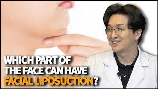 Which part of the face can have Facial Liposuction procedure?