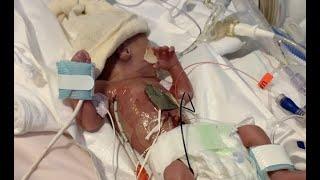 OUR NICU JOURNEY // 25 WEEKER MICRO-PREEMIE