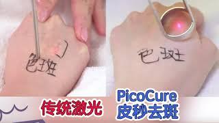 悉尼医美 - 传统激光 vs PicoCure皮纳秒激光