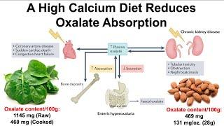 A High Calcium Diet Reduces Oxalate Absorption