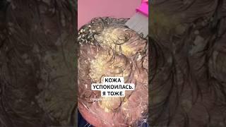 Больше не прячусь под длинными рукавами. Этот крем помог вернуть коже мягкость и покой.