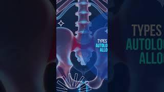 Bone Marrow Transplant at Acıbadem Healthpoint