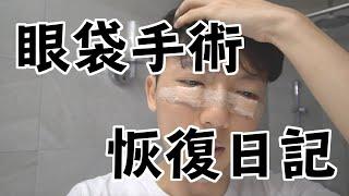 韓國眼袋手術恢復日記 / 毛巾到底有沒有變帥？/ 工程師改造計畫