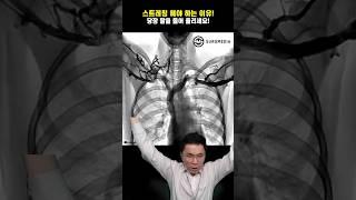 지금 당장 팔을 올리세요! (상세 설명은 댓글)