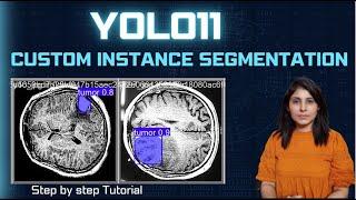 YOLO11 Instance Segmentation on Custom dataset