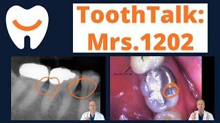 Dental Options Explained - Mrs.1202's ToothTalk | Teledentistry