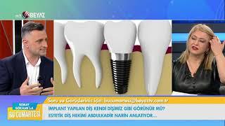 Bir günde implant Estetik Diş Hekimi Abdulkadir Narin