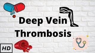 Deep vein thrombosis, Causes, Signs and Symptoms, Diagnosis and Treatment.