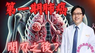 第一期肺癌開刀之後的治療：術後輔助性治療的必要性? Post-Surgery Treatment for Stage I Lung Cancer:?